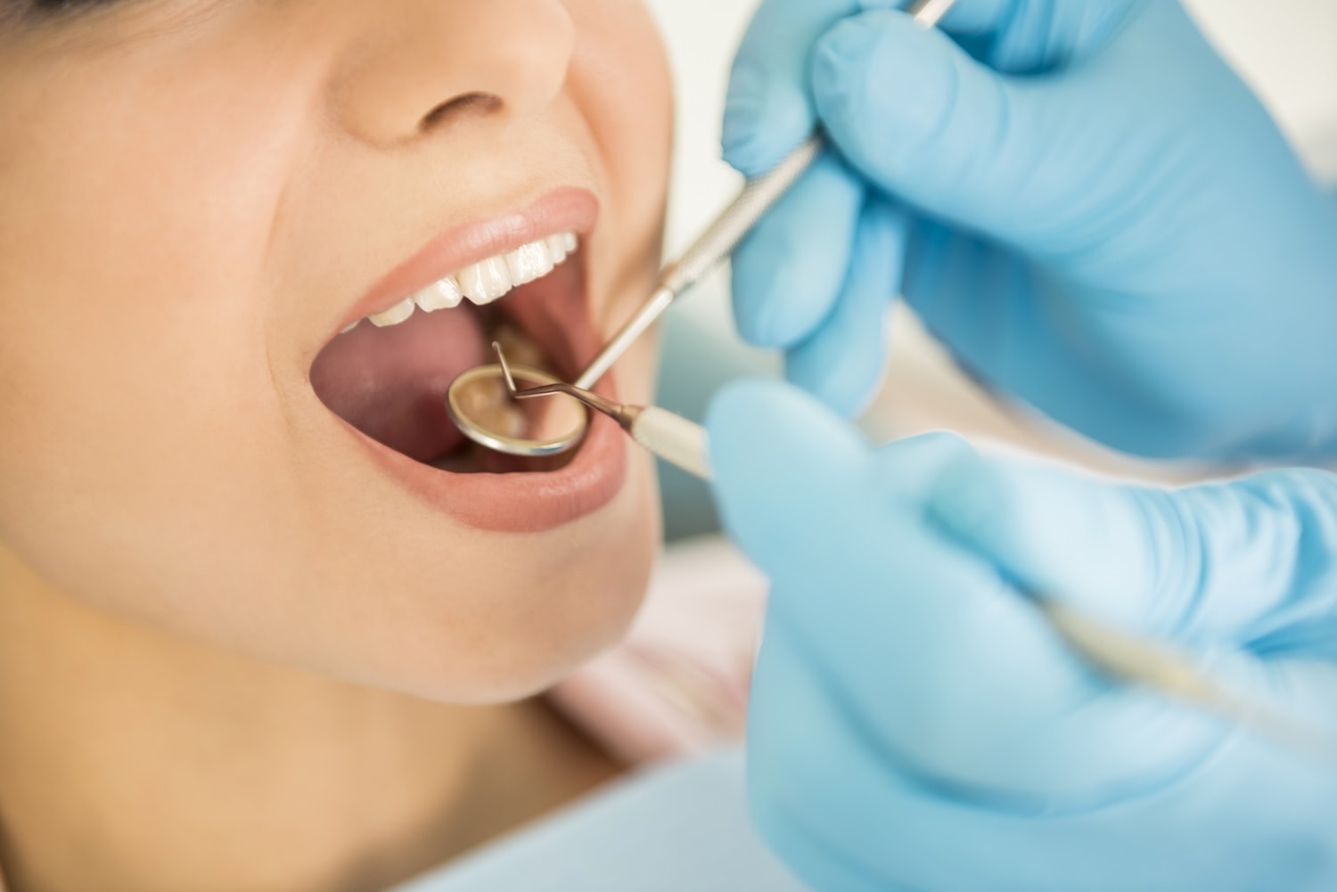 prevencion endodoncia